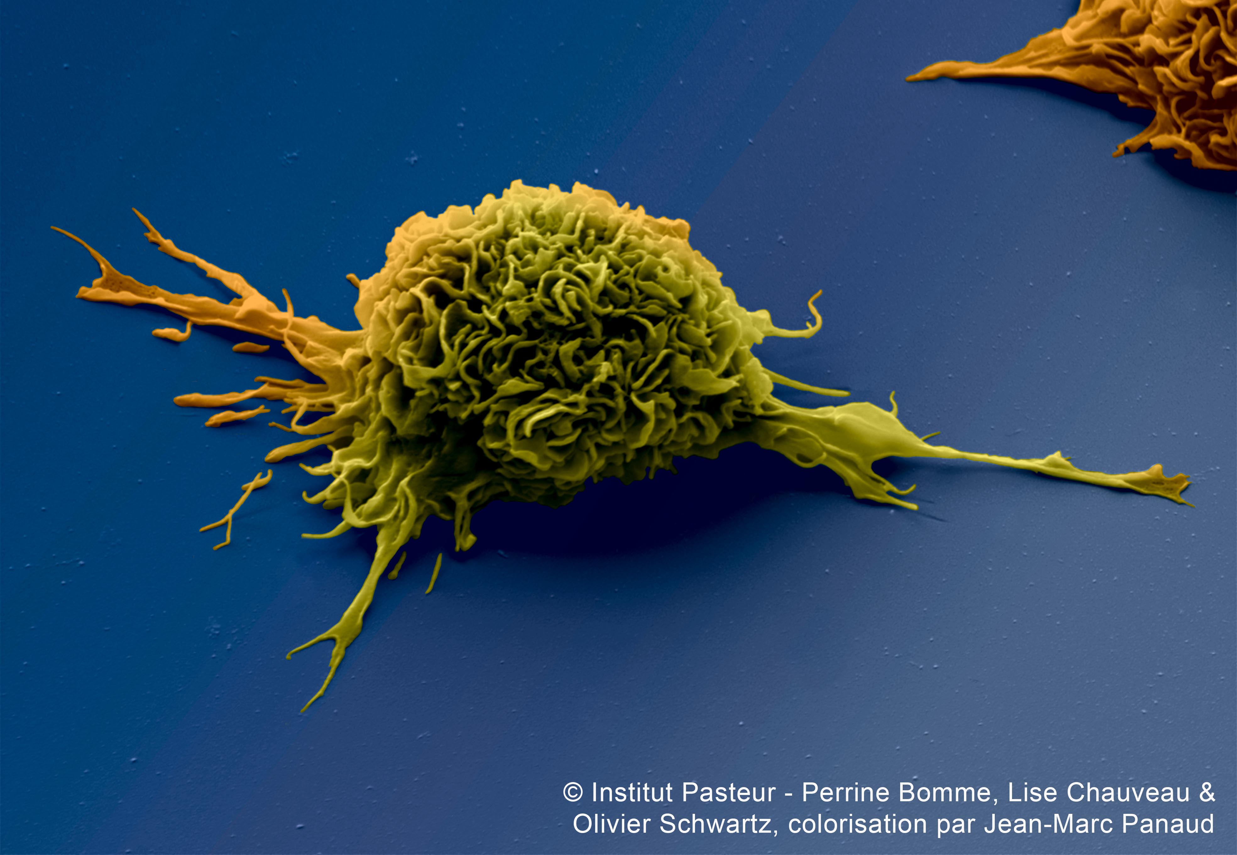 Cellule dendritique Institut Pasteur - Perrine Bomme, Lise Chauveau & Olivier Schwartz, colorisation par Jean-Marc Panaud